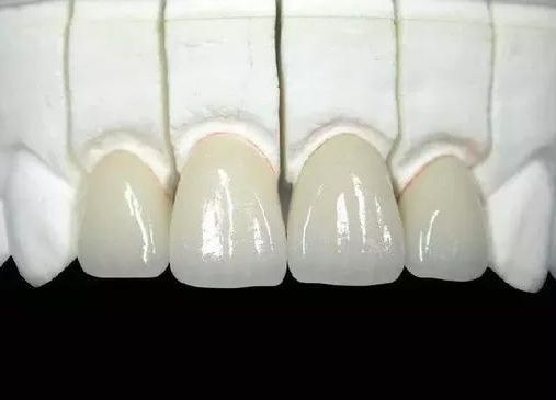 北京有哪些醫(yī)院割雙眼好？推薦一家口碑好的醫(yī)院