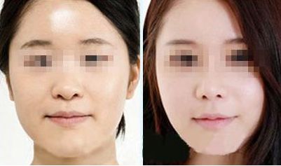 武漢治療痘印哪家醫(yī)院好？TOP10醫(yī)療整形機(jī)構(gòu)排名揭曉！