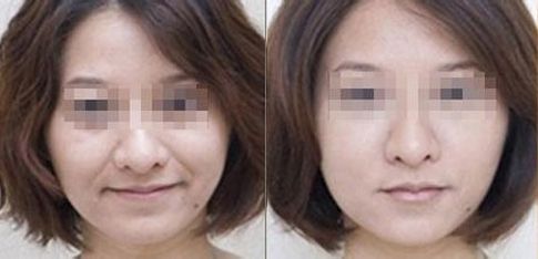 杭州動(dòng)態(tài)細(xì)紋美容醫(yī)院口碑排行榜揭秘：前10名深度評(píng)析！