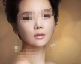 石家莊埋線雙眼皮十大口碑好醫(yī)院實(shí)力測(cè)評(píng)榜單