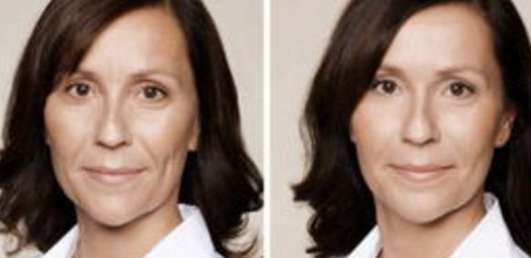 上海王艷鼻部修復(fù)：專業(yè)醫(yī)生解析失敗原因及修復(fù)方案