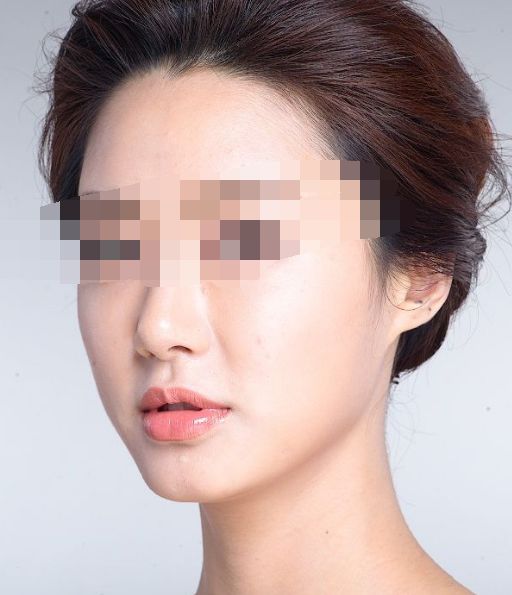 西安全身吸脂瘦身，十家整形醫(yī)院盤(pán)點(diǎn)！