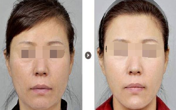 四川醫(yī)美界翹楚：成都去唇紋醫(yī)院實力大比拼