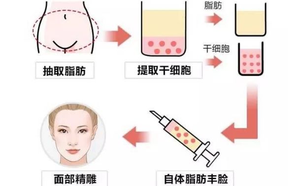 【鼻綜合】吳玉家醫(yī)生推薦│費(fèi)用介紹│坐診醫(yī)院及專家評價！