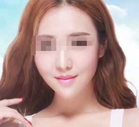 廣州哪家專業(yè)整形醫(yī)院鼻綜合治療好？皇佳貝麗提供舒適就診環(huán)境