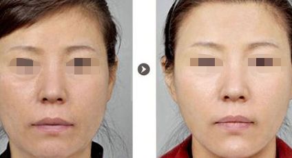 權(quán)威盤點：綿陽墊下巴卓越整形機構(gòu)TOP榜單