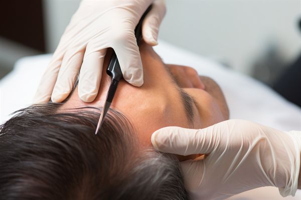 李國珍醫(yī)生鼻子整形效果如何？上海美麗之星醫(yī)院值得考慮！價格合理！