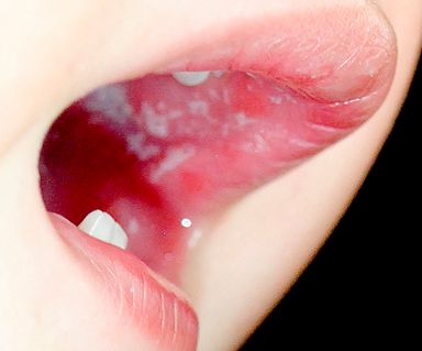 福州美容整形醫(yī)院排名及網友口碑如何？