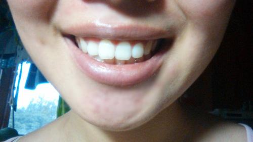 肇慶匯總靠前的整形醫(yī)院，哪家效果更好？2023整形價(jià)格一覽表