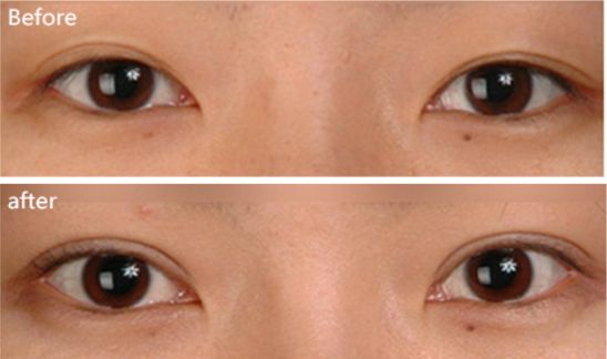 上海治痘痘好的醫(yī)院有哪些？