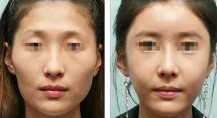 廣西嘴巴整形哪家醫(yī)院好？選前沿技術(shù)引領(lǐng)的醫(yī)療機(jī)構(gòu)，實(shí)測推薦最佳！