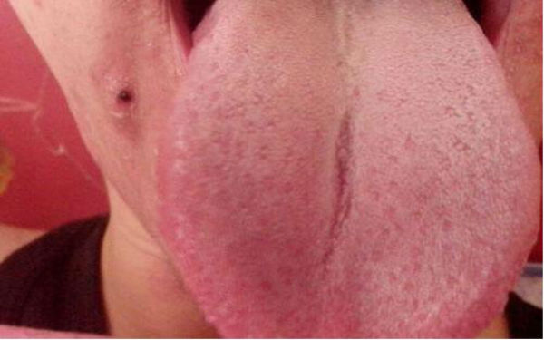 專業(yè)推薦！重慶耳朵畸形治療，這幾家醫(yī)院值得關注