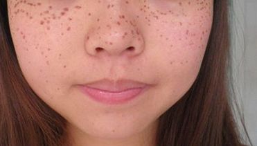 合肥三甲醫(yī)院美容科哪家好？探尋最受用戶歡迎的合肥三甲醫(yī)院美容科