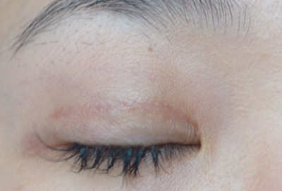 長(zhǎng)沙下巴縮矯正醫(yī)院全球杰出名單揭曉！2023長(zhǎng)沙下巴縮矯正整形醫(yī)院統(tǒng)治排行榜震撼發(fā)布！