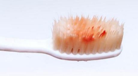 哪家南寧整形醫(yī)院更專業(yè)治療眼睛細(xì)紋微整形？2023南寧眼睛細(xì)紋微整形正規(guī)美容醫(yī)院排行榜同城精選！