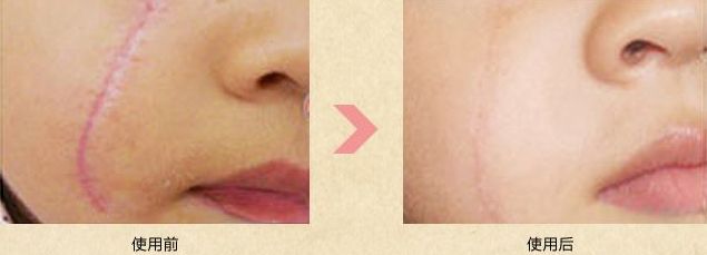 南陽割眼皮最好的醫(yī)院有哪些？