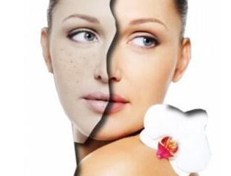 阜陽(yáng)激光美容醫(yī)院哪家好？專家推薦阜陽(yáng)激光祛痘效果最好的醫(yī)院