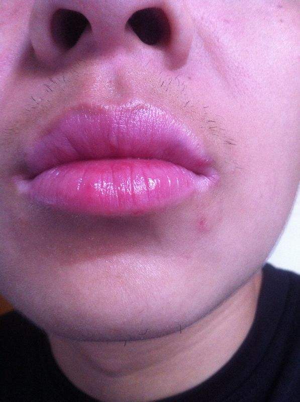 熱瑪吉美容術(shù)的步驟如何？輕松關(guān)注，非手術(shù)熱瑪吉真的有效嗎？