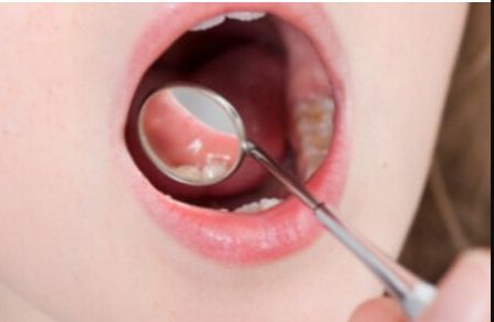 深圳哪家醫(yī)院做豐胸手術(shù)效果好？