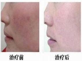 常州激光疤痕醫(yī)院哪家好？專家告訴你如何選擇靠譜的醫(yī)院！