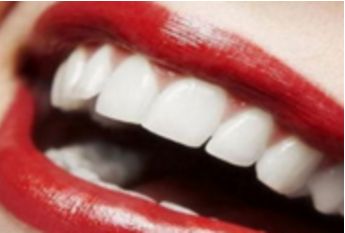 上海哪家醫(yī)院玻尿酸除皺效果最佳？