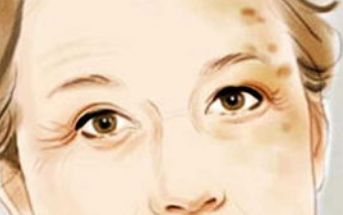 佛山哪個醫(yī)院做面部吸脂效果好？