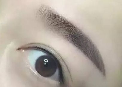 重慶自體豐胸去哪里找？重慶自體豐胸哪家醫(yī)院好？