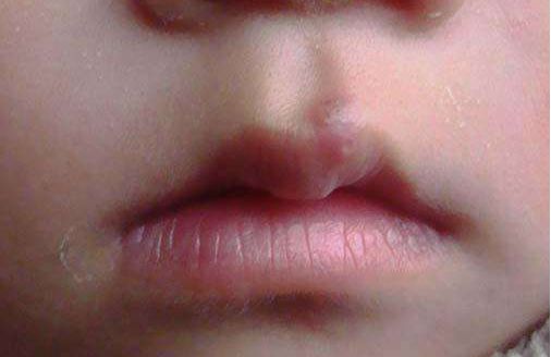 濟(jì)南哪家醫(yī)院做玻尿酸好？選擇時(shí)要注意這幾個(gè)關(guān)鍵點(diǎn)