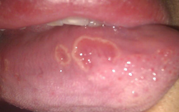 2023年上海最具聲譽的硅膠膨體植入隆鼻整形醫(yī)院排名前10！