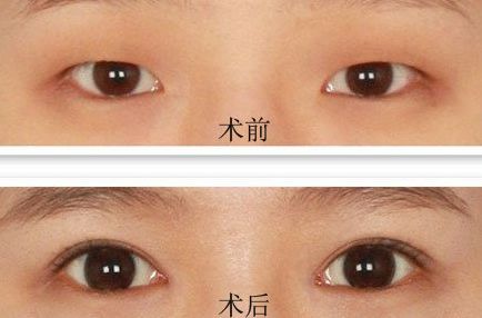 蘇州科技城醫(yī)院、蘇大附一醫(yī)院整形口碑價格一覽，一鍵查詢！