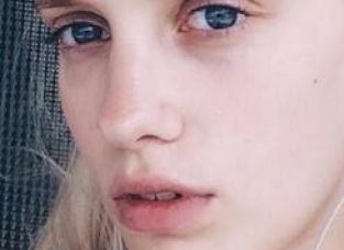 具惠善整容：探索明星整容現(xiàn)象背后的觀念轉(zhuǎn)變與社會(huì)影響