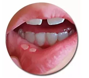 鄭州botox醫(yī)院哪家好？比較專業(yè)的botox醫(yī)院排行榜有哪些？