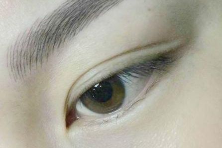 上海熱瑪吉除皺哪家好？選擇專業(yè)機構，實現(xiàn)完美肌膚！