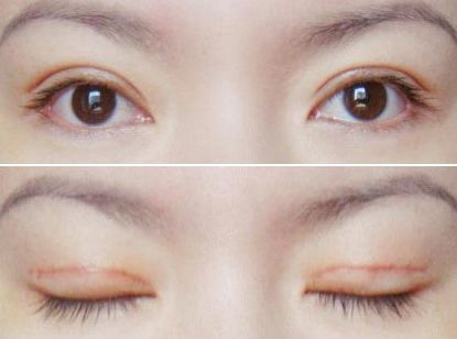 2023年西安受歡迎的整形醫(yī)院推薦！教你選擇靠譜醫(yī)美機(jī)構(gòu)