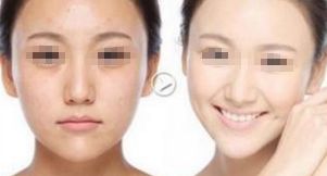 合肥鼻整形醫(yī)院排行榜發(fā)布！推薦醫(yī)療機構華美、安徽省立醫(yī)院、藝星