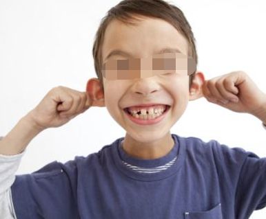 夏文森鼻整形技術解析，醫(yī)生的專業(yè)程度如何