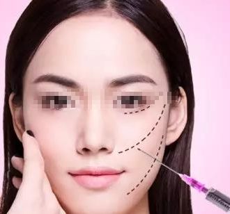 廣州激光吸脂瘦腰整形醫(yī)院口碑排行榜大揭秘