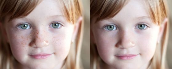 上海隆鼻哪位醫(yī)生比較好？推薦十位專家，陳付國、王會勇、邱文苑等匯集！