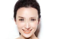 鄭州細(xì)紋填充脂肪美容醫(yī)院排名前10大揭曉