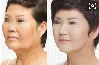 西寧眼底紋填充醫(yī)院推薦：口碑實(shí)力排行榜