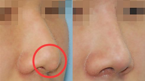 臺州太陽穴凹陷填充：盤點10位經(jīng)驗豐富的整形醫(yī)生