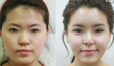 東莞韓式定位雙眼皮 10 家匠心整形醫(yī)院大盤點