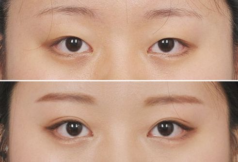 昆明私密整形哪家口碑好，全面解析昆明私密整形醫(yī)院排名和用戶評價