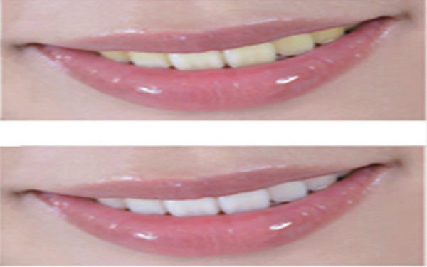 2023年吉林眼角祛黃褐斑整形醫(yī)院排名前10強已公布