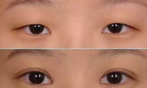 上海哪家醫(yī)院干細(xì)胞去細(xì)紋整形性價(jià)比高？2023年十強(qiáng)口碑榜揭曉！