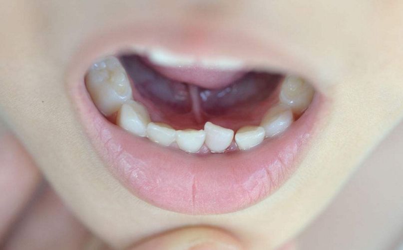 分享FX整容經(jīng)驗(yàn)，助您開(kāi)啟新面貌