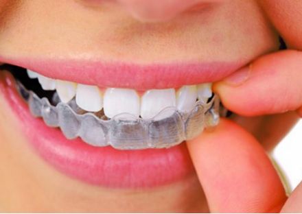 太田痣廣州哪家醫(yī)院治療效果最好并且價(jià)格實(shí)惠？