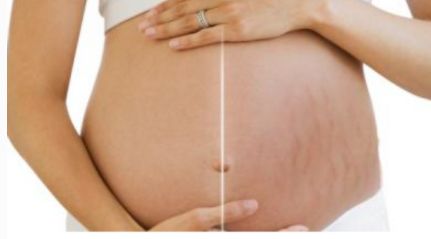 如何選擇保定市治療鼻子疾病最好的醫(yī)院？