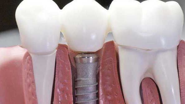 南京最新祛疤產(chǎn)品哪家好？一文詳解南京地區(qū)最適合的祛疤產(chǎn)品推薦