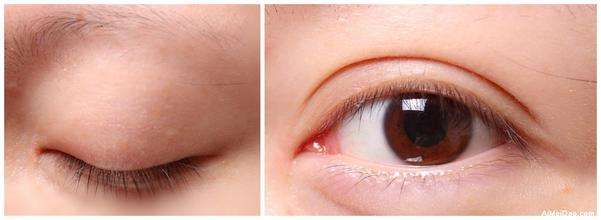 2023年成都填充顳部凹陷效果突出的美容醫(yī)院排行榜公布！權(quán)威推薦，讓你美麗不留死角！